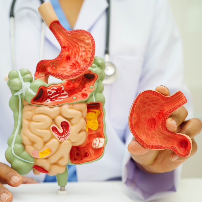 Surgical Gastroenterology